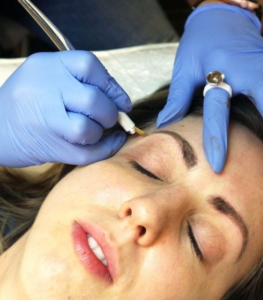 Microblading